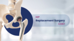 Joint replacement surgery services India